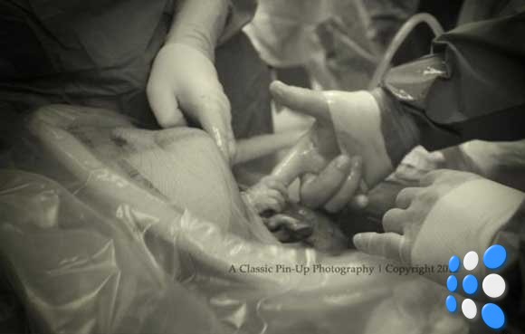zapanjujuca-fotografija-na-kojoj-beba-iz-majcine-utrobe-hvata-doktorov-prst